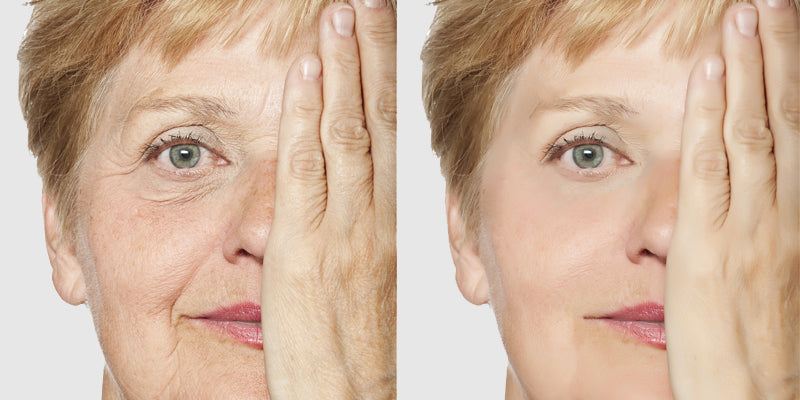 How Blue Light Speeds Up Skin Aging: Protect Your Skin Effectively