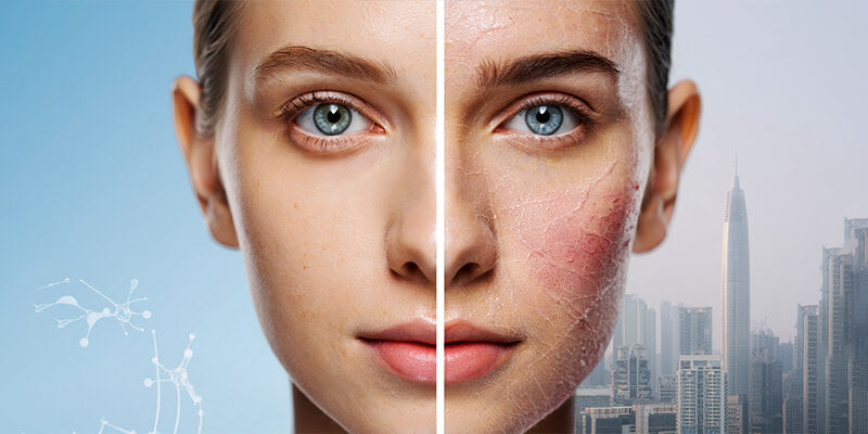 How Air Pollution and Ultraviolet Exposure Affect Skin in Pakistani Cities & How to Protect It