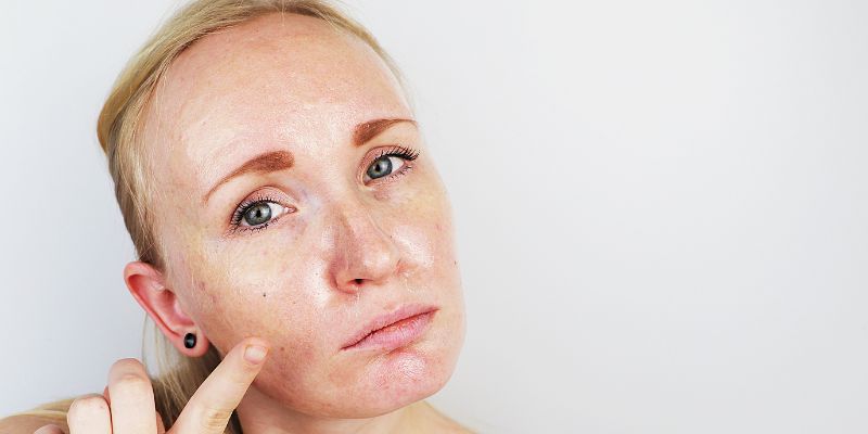 The Oily Dilemma: Reasons and Effects