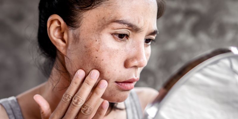 Skin Salvation: Natural Remedies for Skin Issues