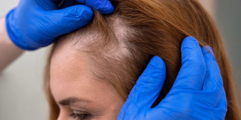 Tips for Hair Growth: Thicken and Regrow Hairs with Us