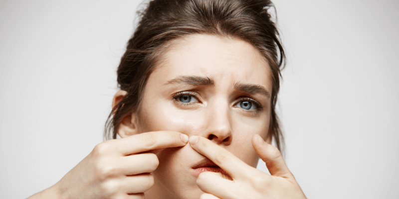 Natural Remedies for Acne: Reasons and Effects