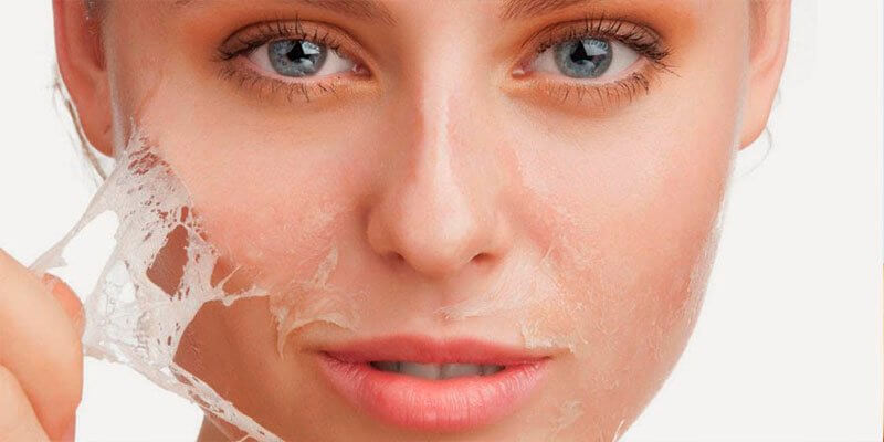Skin Peeling: Practical Tips to Prevent Your Skin from Peeling