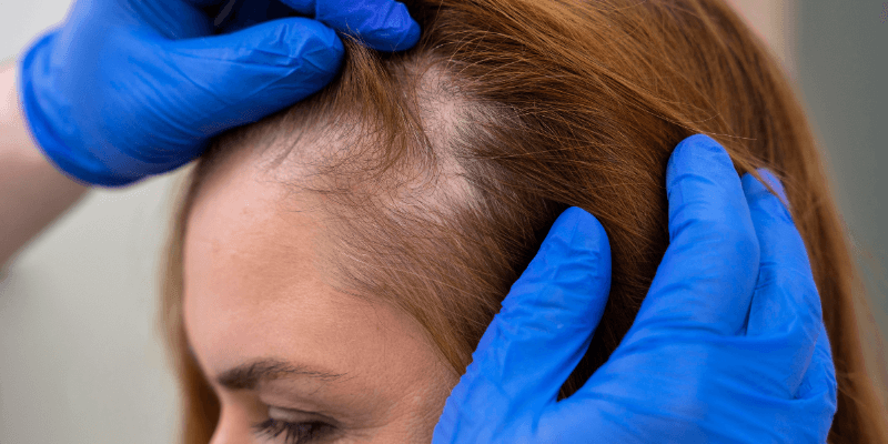 women getting regrow hair treatment for hair thickness